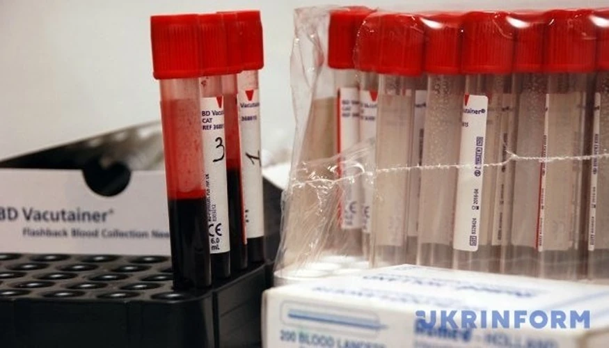 ВІЛ та СНІД / © pixabay.com